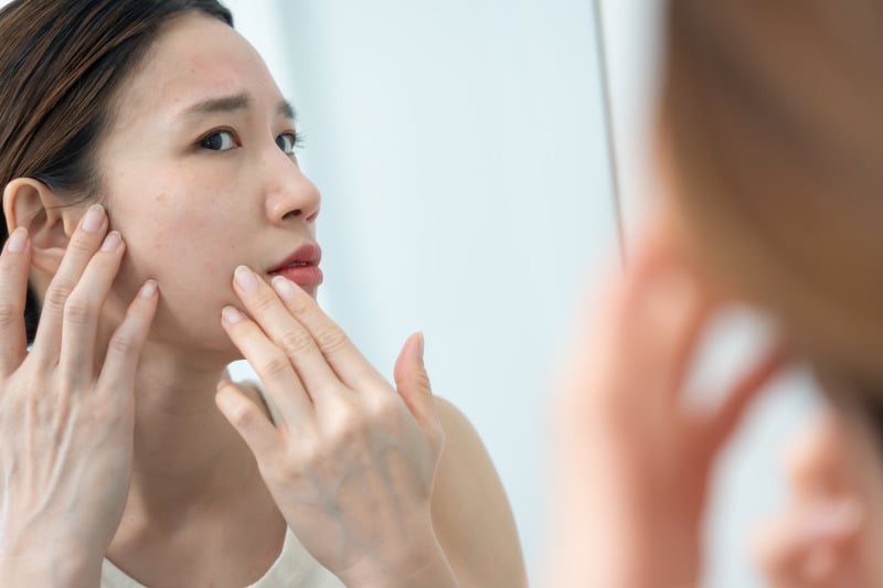 Những lưu ý khi sử dụng Emmié cho làn da nhạy cảm